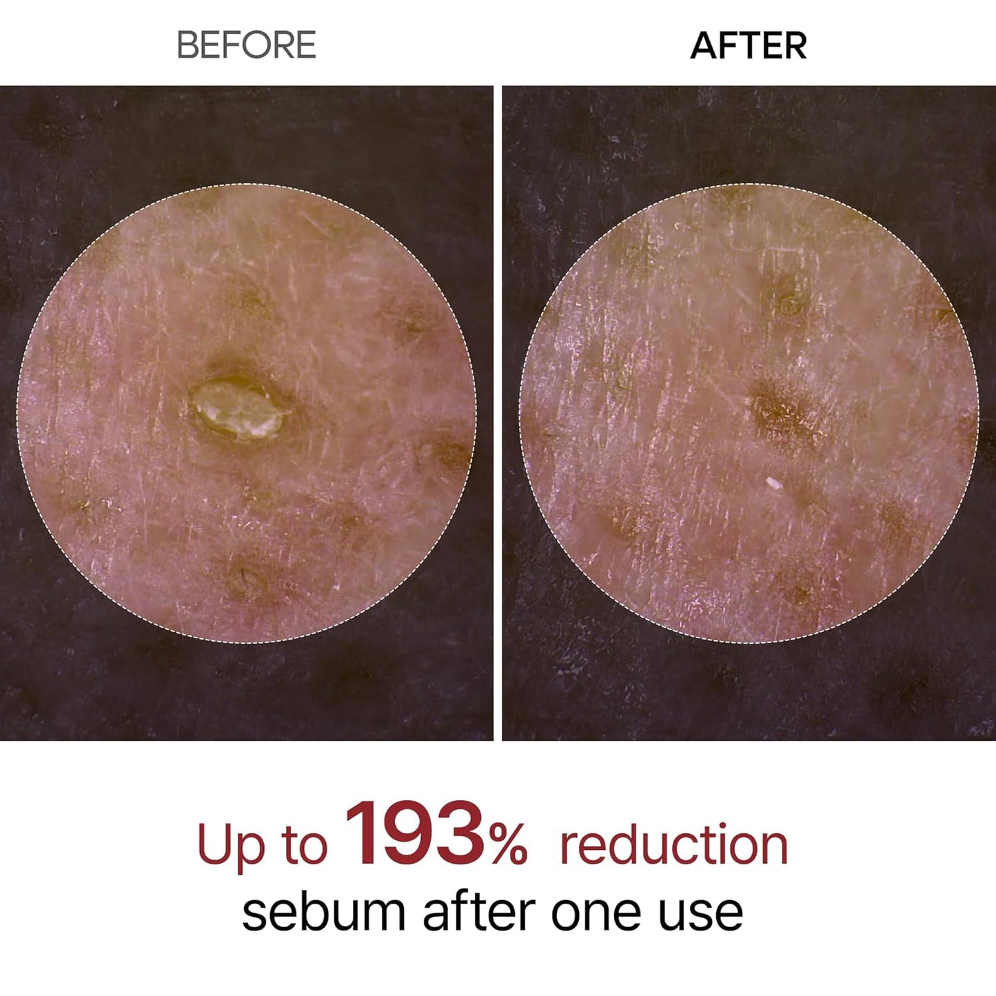 Radiance Renewal Ampoule Duo™